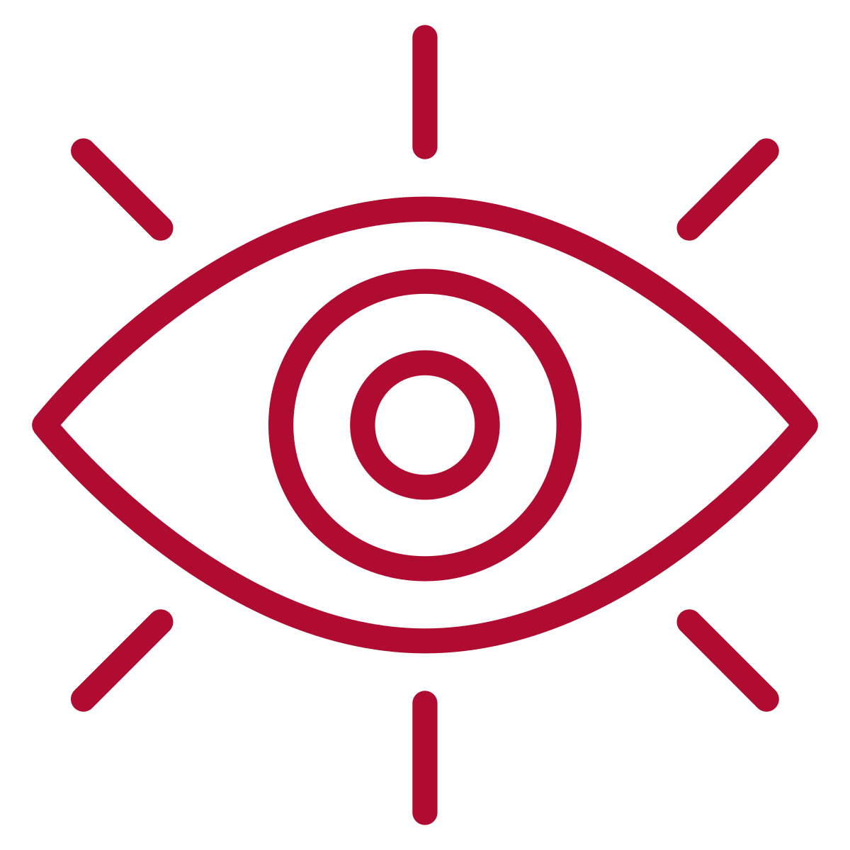 Vision